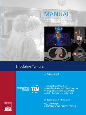 cover image of Endokrine Tumoren